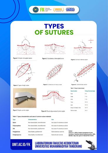 Poster Types of Sutures di Clinical Skills Lab